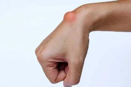 cuerpos raros en la piel y su explicación