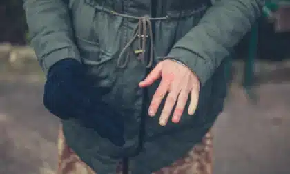 Fenómeno de Raynaud